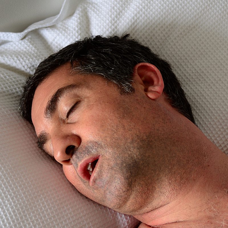 What Is Central Sleep Apnea?