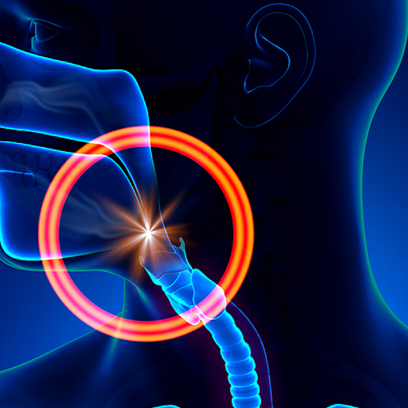 Is Sleep Apnea an Epidemic?