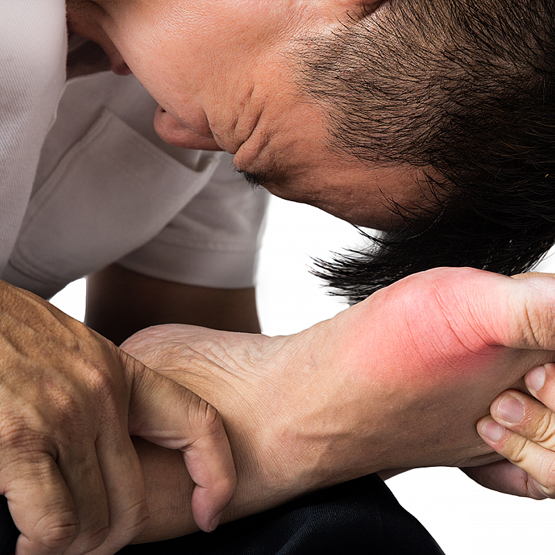 The Connection Between Sleep Apnea and Gout Flares