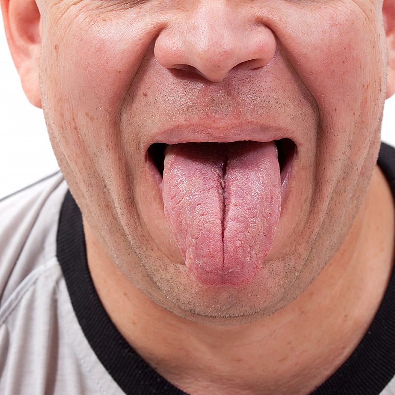 Can Tongue & Throat Exercises Help Sleep Apnea?